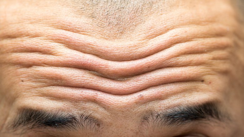 forehead wrinkles