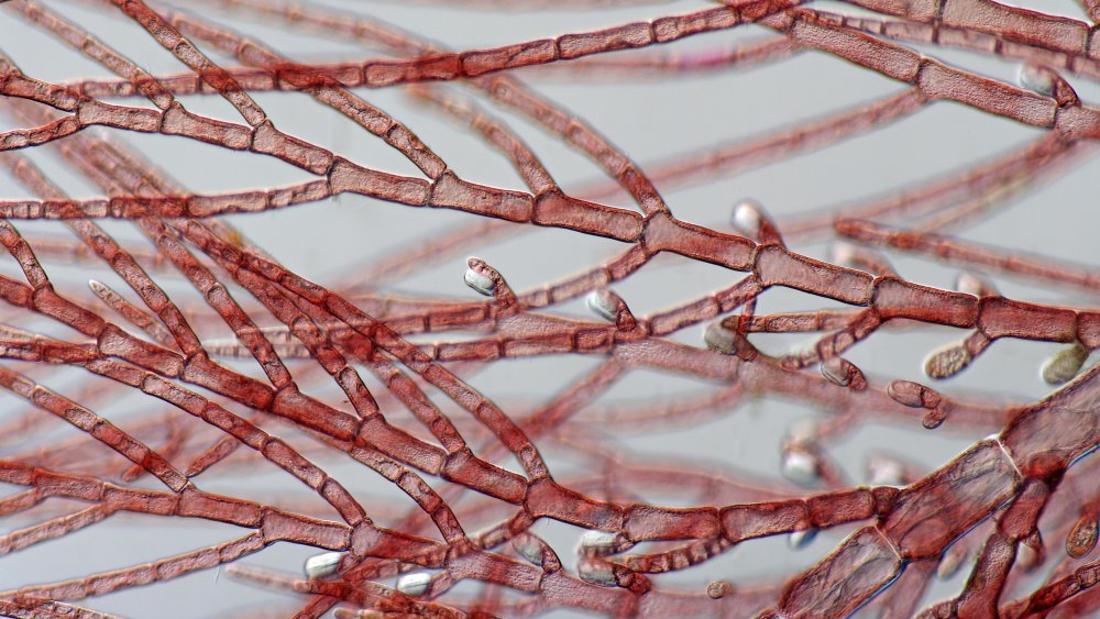 red algae under microscope