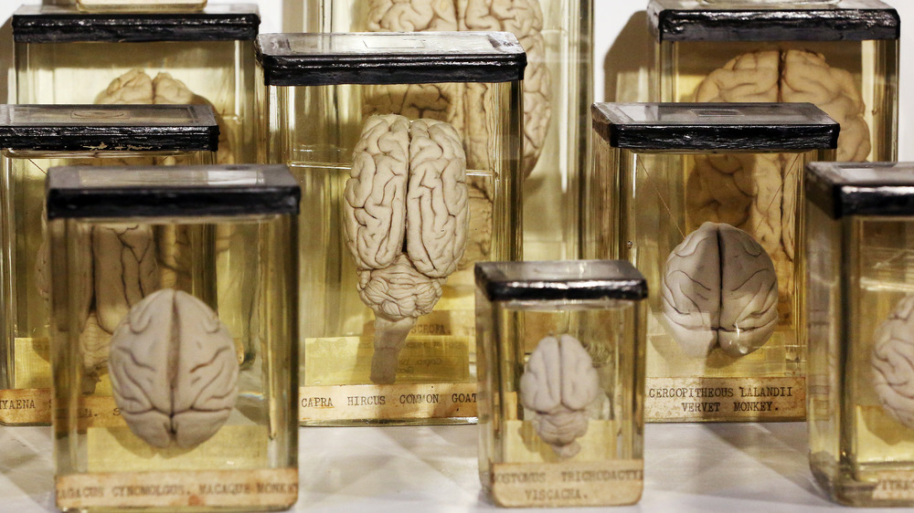 Brains in jars
