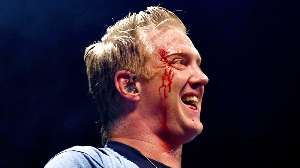 Josh Homme with blood on his face