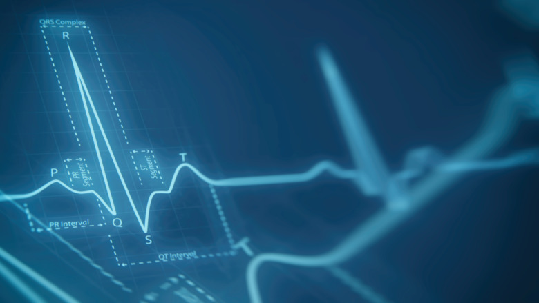 cardiogram showing activity spikes