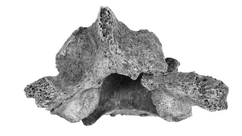 A vertebra