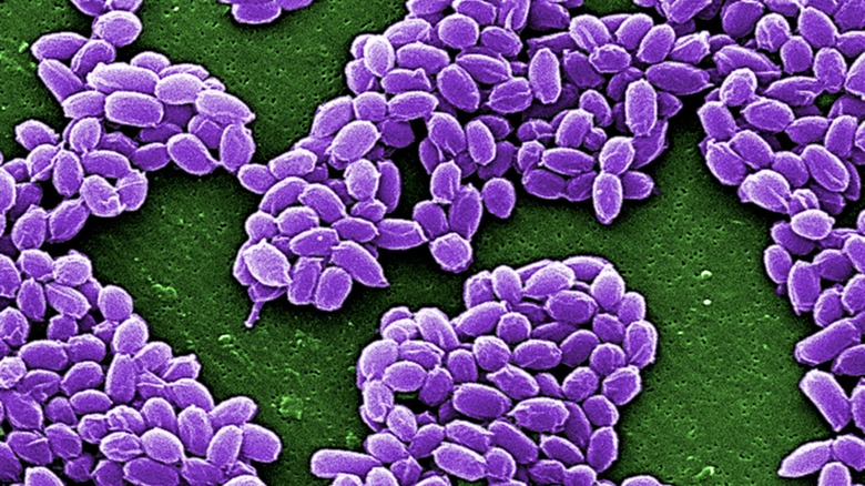 anthrax spores