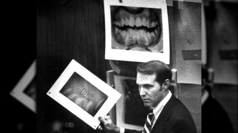 Ted Bundy dental evidence