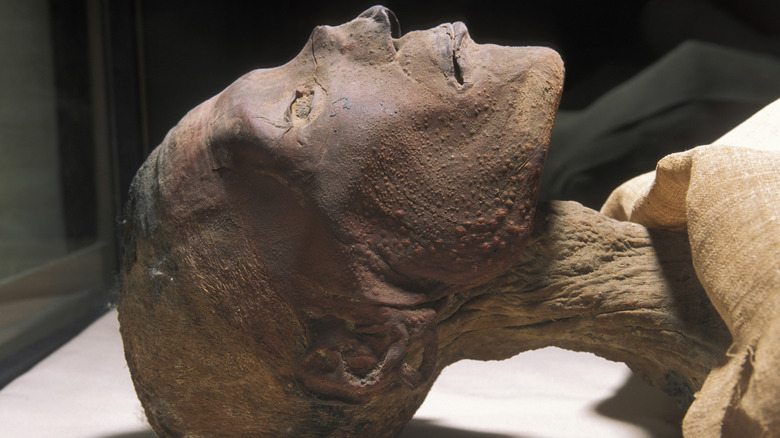 mummified remains