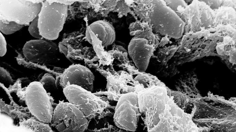 Yersinia pestis