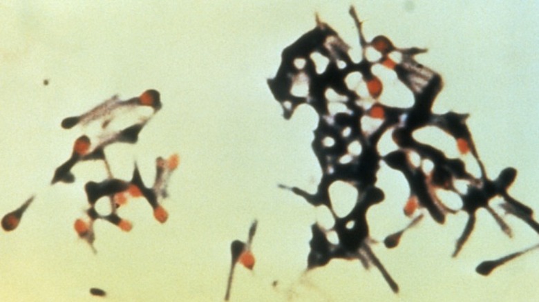 Clostridium tetani