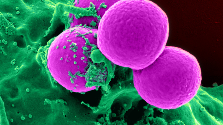 Methicillin-resistant Staphylococcus aureus