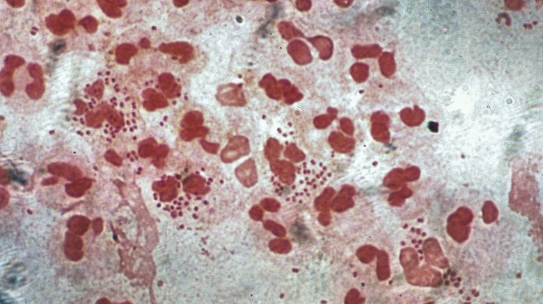 Neisseria gonorrhoeae