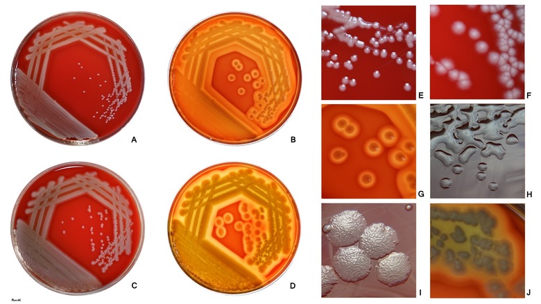 Pseudomonas aeruginosa