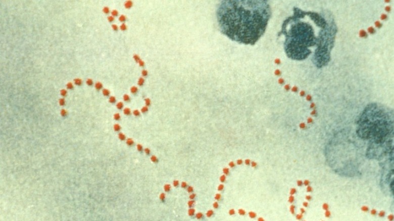 Streptococcus pyogenes