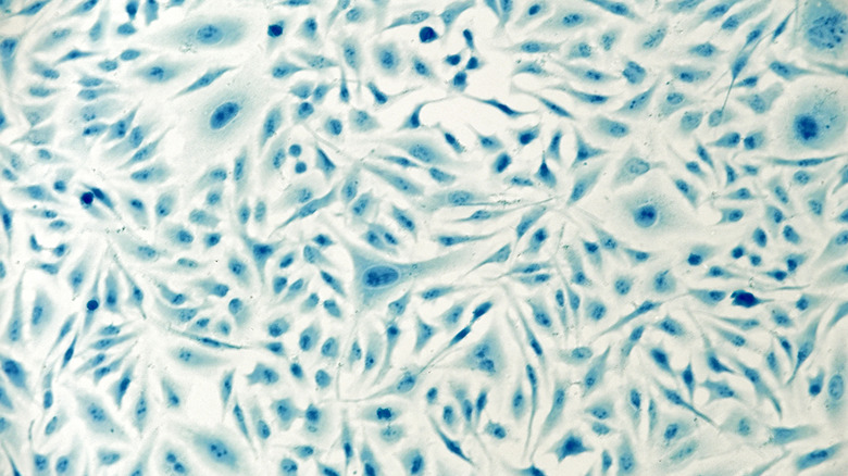 HeLa cervical cancer cells under microscope