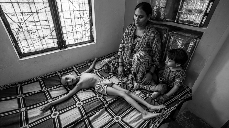 children born after bhopal leak
