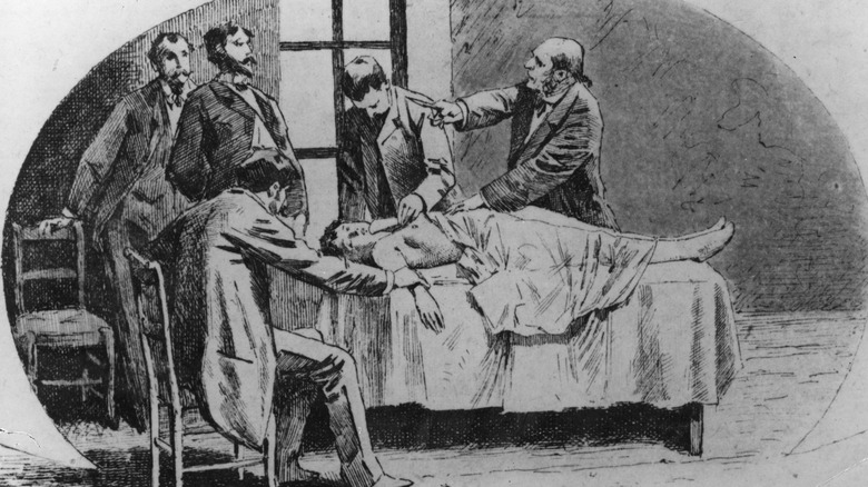 19th century surgery in progress