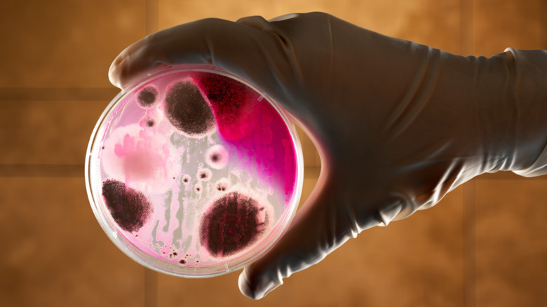 anthrax in a petri dish