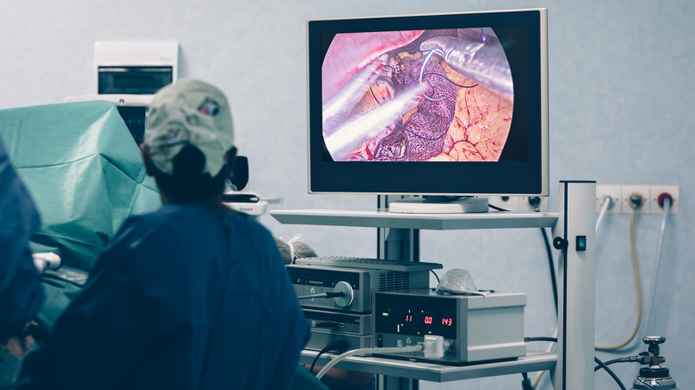 Doctors looking at video of stomach