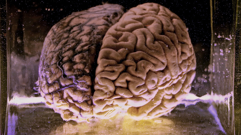 brain preserved in jar