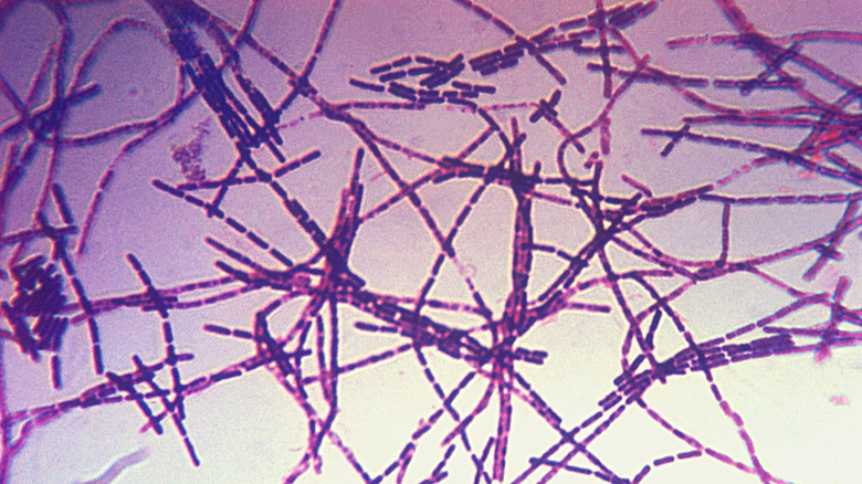 Bacillus anthracis Gram