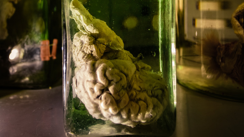 brain disection