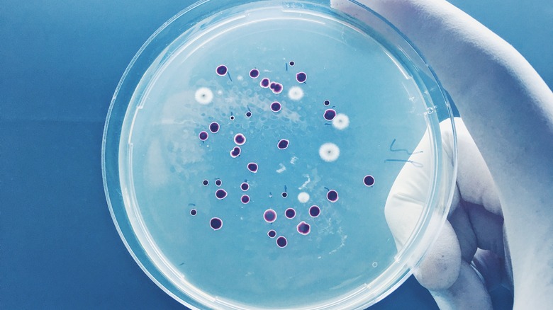 A petri dish of microorganisms