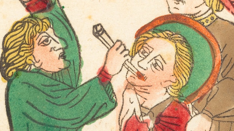 Medieval drawing of tooth removal